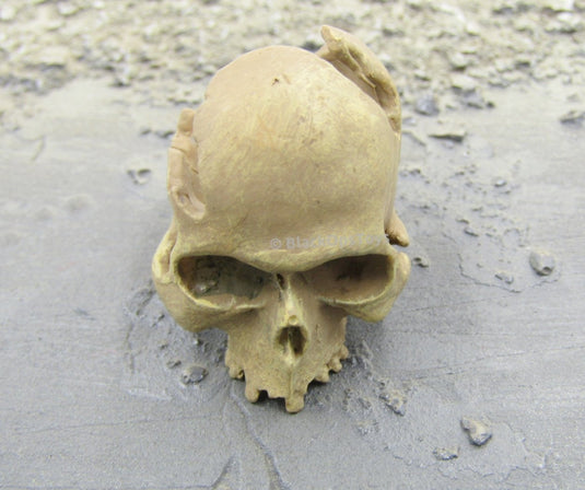 Shattered Human Skull